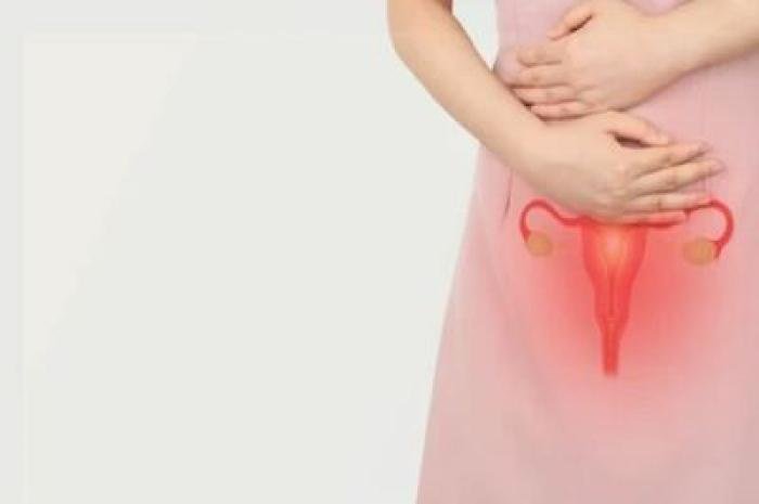 How to Reverse PCOS with Diet and Lifestyle?